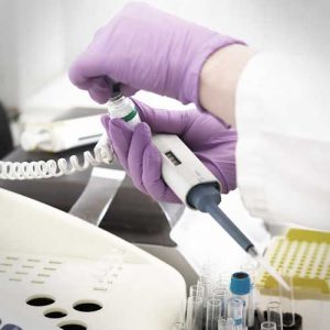 Aarogyam C Blood Test